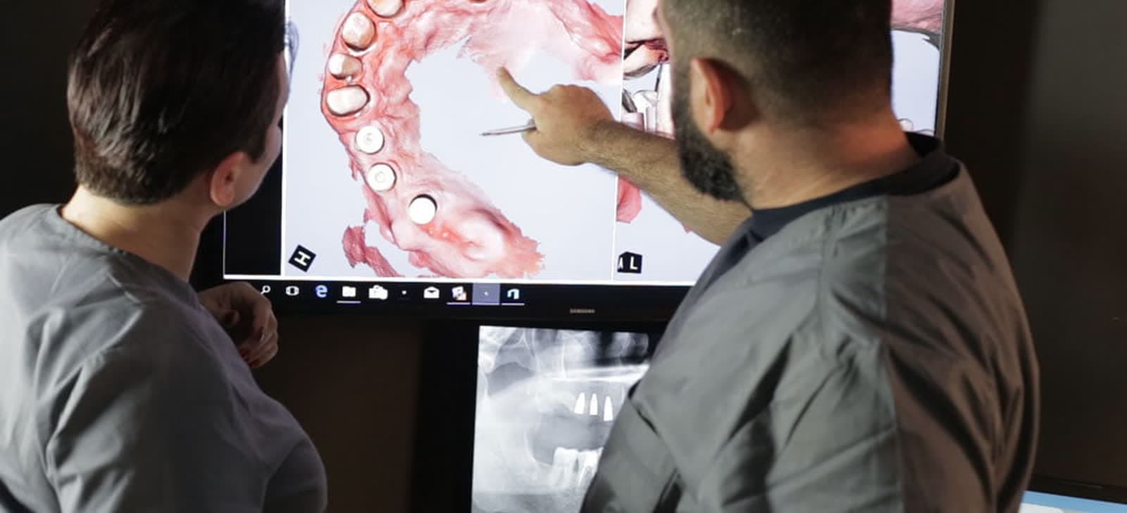 Doi medici analizează scanarea 3D a unui caz, pe ecranul din clinică